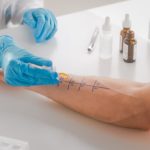 Allergologia Santagostino Genova
