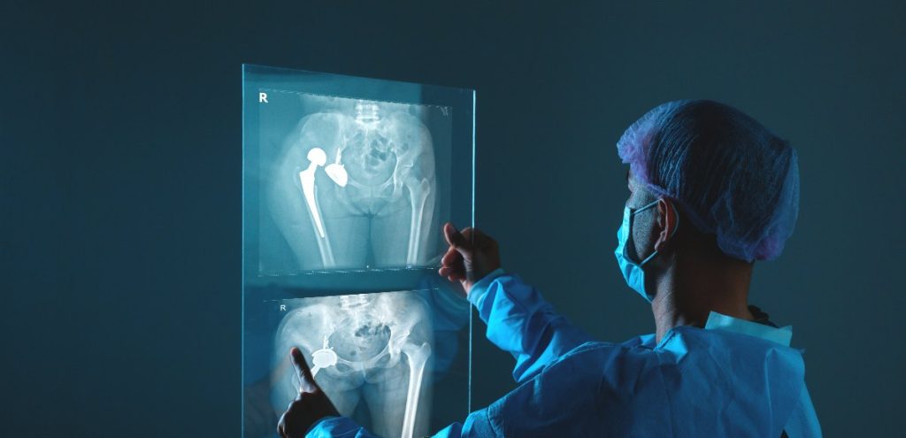 Osteoporosi