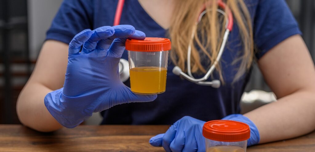 analisi delle urine