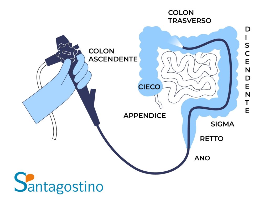 percorso endoscopio santagostino genova