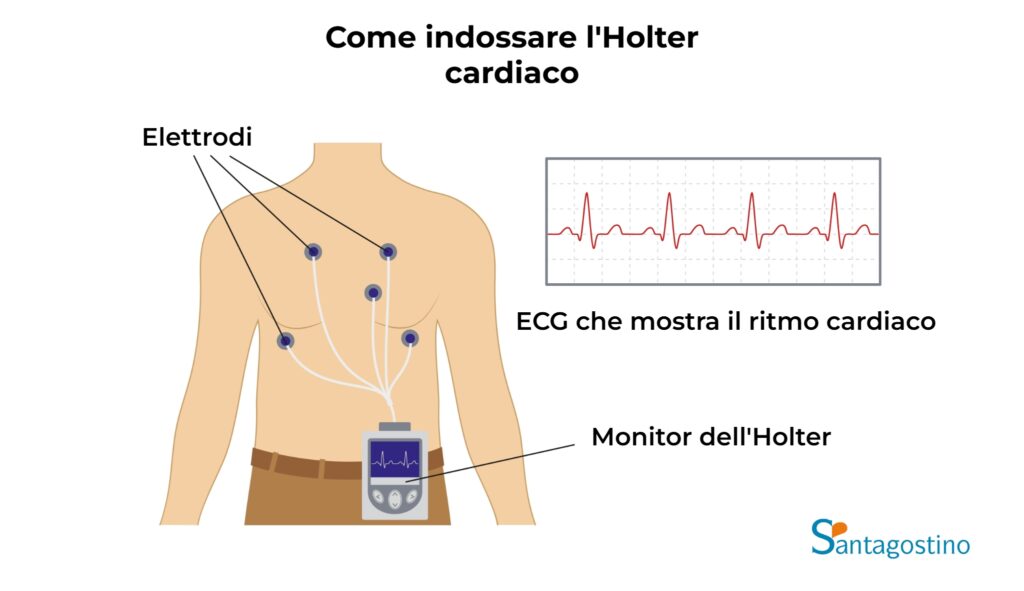 Come funziona holter cardiaco santagostino genova