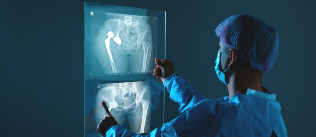 radiografia santagostino genova