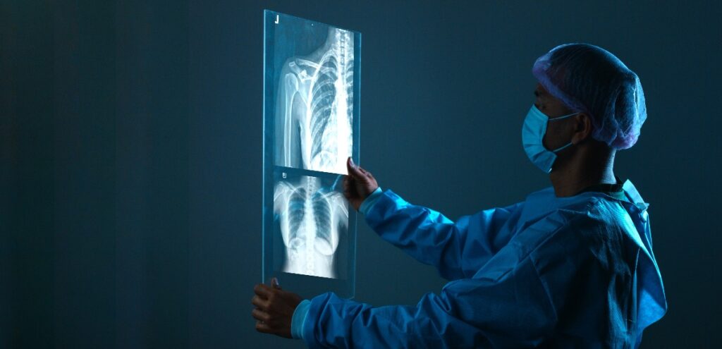 radiografia ai polmoni