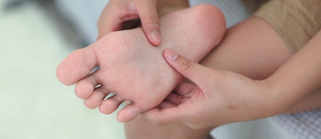 fascite plantare santagostino genova