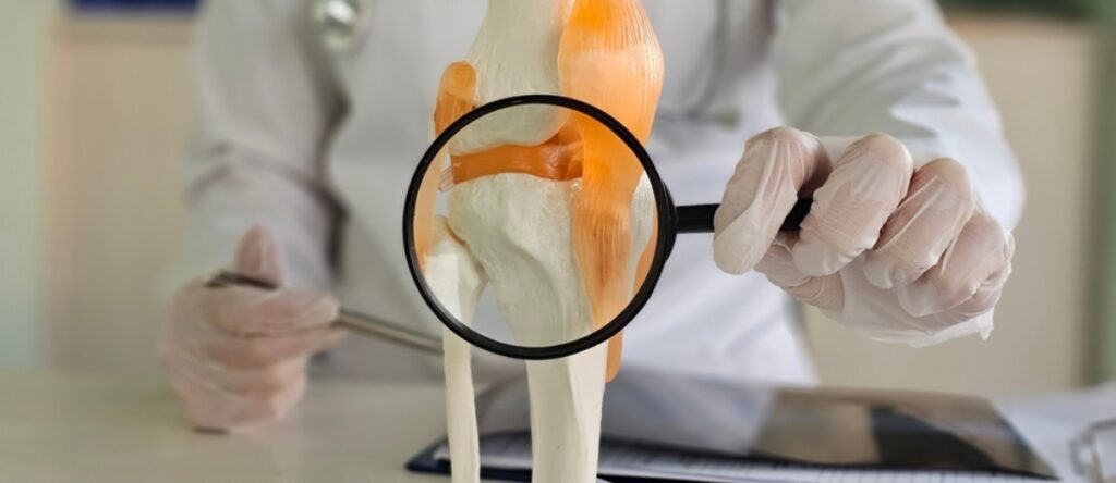 lesione menisco santagostino genova