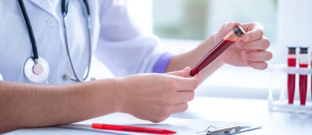 esami sangue santagostino genova