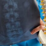 radiografia schiena genova