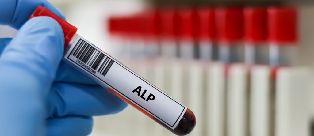 fosfatasi alcalina santagostino genova