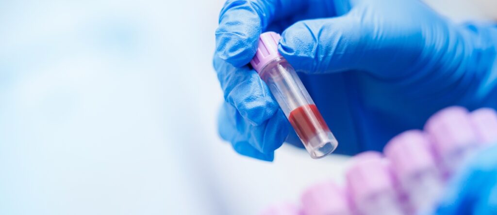 glucosio santagostino genova