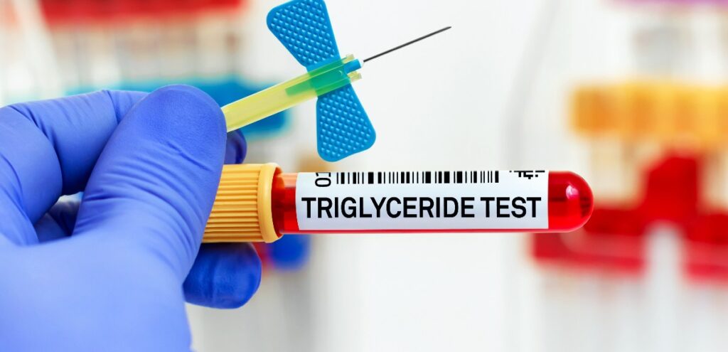 trigliceridi alti