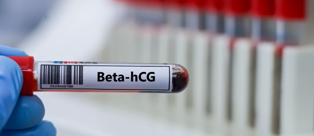 beta hcg santagostino genova